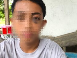 Remaja di Mangkutana Diduga Jadi Korban Penganiayaan, Keluarga Lapor Polisi